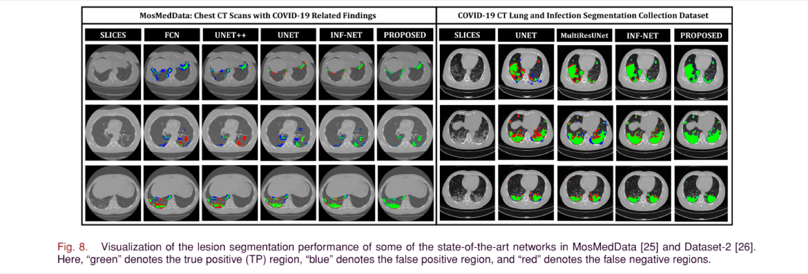 Grid of CT slices with segmentation overlays from FCN, UNet++, UNet, Inf-Net, and the proposed method on MosMedData, and UNet, MultiResUNet, Inf-Net, and the proposed method on a second dataset. Green marks correctly segmented lesion, blue false positives, red false negatives